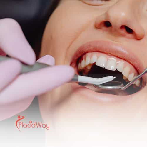 How to Save on Full Mouth Restoration in Thailand as a New Zealand Resident